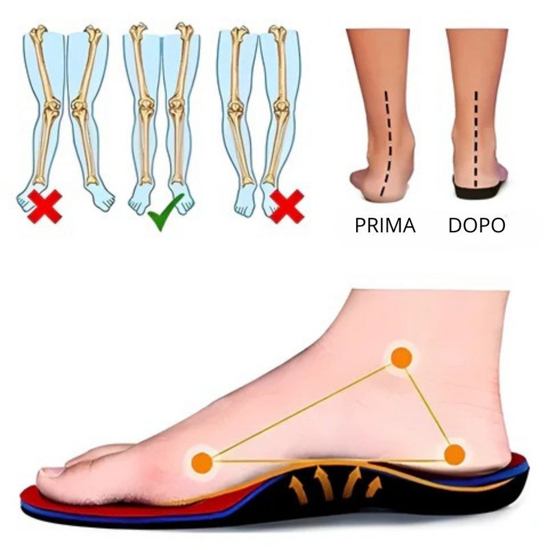 ORTHOPEDIC SHOES FOR WOMEN